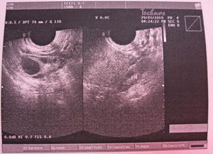 怀孕人绒毛膜促性腺激素对照表（血清人绒毛膜促性腺激素参考值）